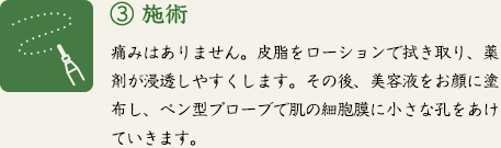 ③ 施術　痛みはありません。皮脂をローションで拭き取り、薬剤が浸透しやすくします。その後、美容液をお顔に塗布し、ペン型プローブで肌の細胞膜に小さな孔をあけていきます。